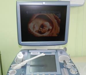 УЗИ беременности в клинике Геном-Томск