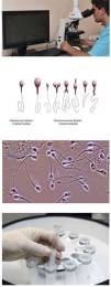 Анализы спермы